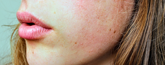 Pourquoi ma peau réagit à tous les produits ? (et pourquoi ce n’est peut-être pas ta peau le problème)